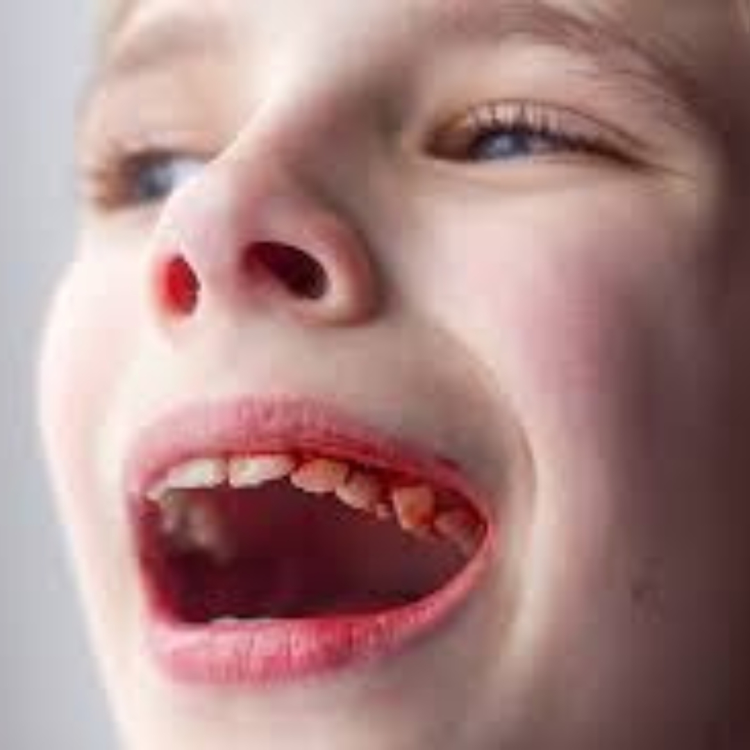 Facial Trauma Repair