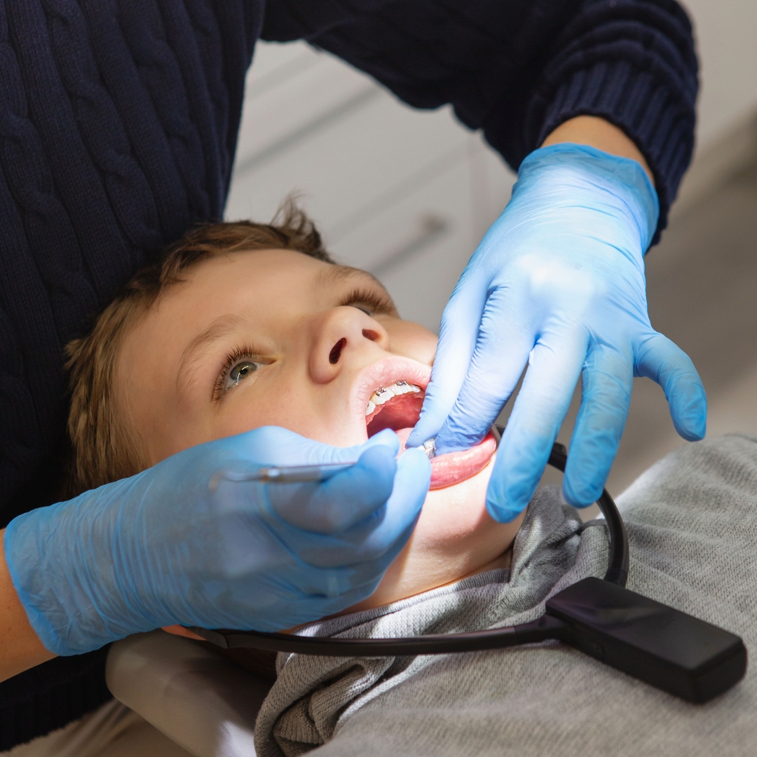 Braces and orthodontic care for children by a pediatric specialist