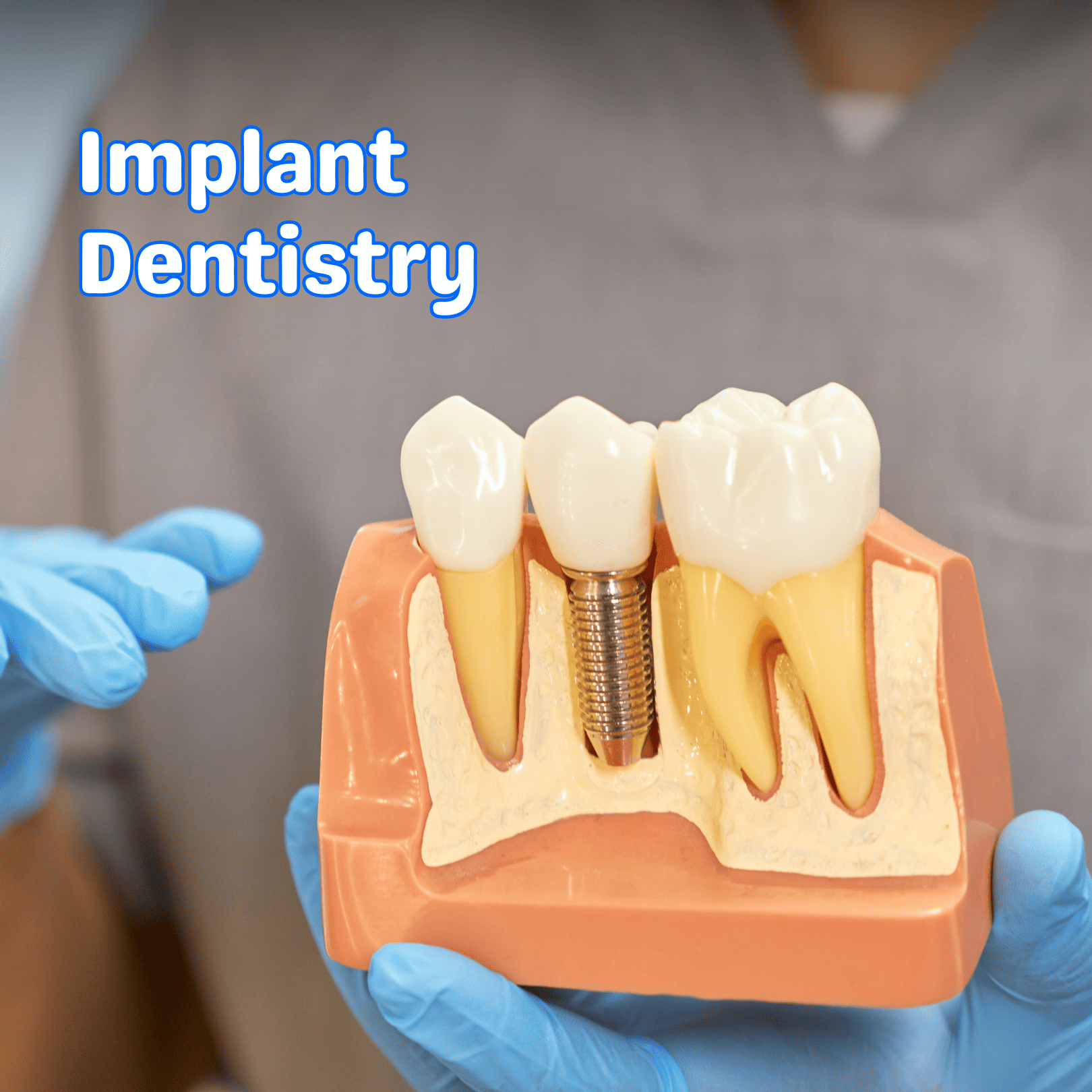 Dental implant services – Restoring your smile with durable, long-lasting implants.