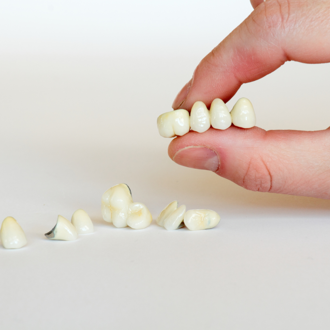 Porcelain Crowns
